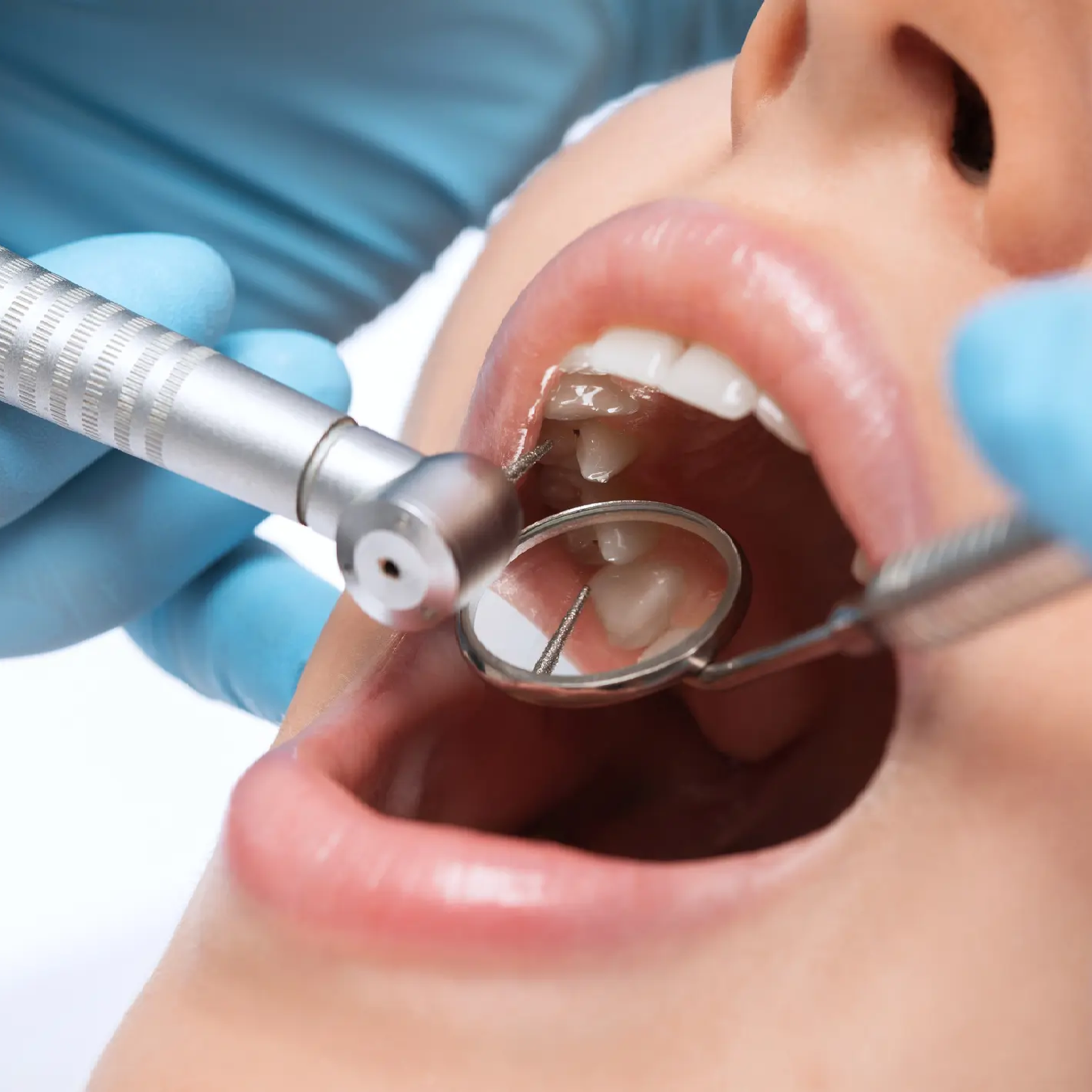 Zahnarzt Wichterich Bischofsheim Zahnersatz